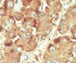 NLK Antibody in Immunohistochemistry (IHC)