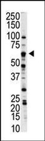 NLK Antibody in Western Blot (WB)