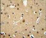 NMB Antibody in Immunohistochemistry (IHC)
