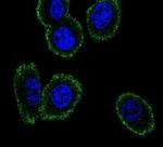 NMB Antibody in Immunocytochemistry (ICC/IF)