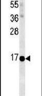 NMB Antibody in Western Blot (WB)