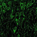 NMDAR1 Polyclonal Antibody