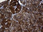 NME1 Antibody in Immunohistochemistry (Paraffin) (IHC (P))