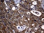 NME1 Antibody in Immunohistochemistry (Paraffin) (IHC (P))