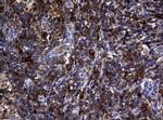 NME1 Antibody in Immunohistochemistry (Paraffin) (IHC (P))