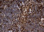 NME1 Antibody in Immunohistochemistry (Paraffin) (IHC (P))