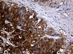 NME1 Antibody in Immunohistochemistry (Paraffin) (IHC (P))