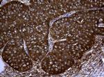 NME1 Antibody in Immunohistochemistry (Paraffin) (IHC (P))
