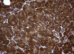 NME1 Antibody in Immunohistochemistry (Paraffin) (IHC (P))
