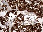 NME1 Antibody in Immunohistochemistry (Paraffin) (IHC (P))