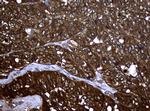 NME1 Antibody in Immunohistochemistry (Paraffin) (IHC (P))