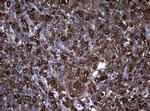 NME1 Antibody in Immunohistochemistry (Paraffin) (IHC (P))