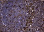 NME1 Antibody in Immunohistochemistry (Paraffin) (IHC (P))