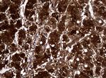 NME1 Antibody in Immunohistochemistry (Paraffin) (IHC (P))