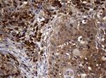 NME1 Antibody in Immunohistochemistry (Paraffin) (IHC (P))