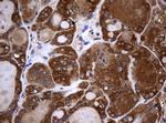 NME1 Antibody in Immunohistochemistry (Paraffin) (IHC (P))