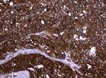 NME1 Antibody in Immunohistochemistry (Paraffin) (IHC (P))