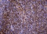 NME1 Antibody in Immunohistochemistry (Paraffin) (IHC (P))