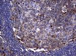 NME1 Antibody in Immunohistochemistry (Paraffin) (IHC (P))