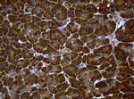 NME1 Antibody in Immunohistochemistry (Paraffin) (IHC (P))