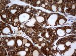 NME1 Antibody in Immunohistochemistry (Paraffin) (IHC (P))