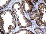 NME1 Antibody in Immunohistochemistry (Paraffin) (IHC (P))