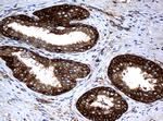 NME1 Antibody in Immunohistochemistry (Paraffin) (IHC (P))