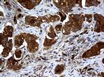 NME1 Antibody in Immunohistochemistry (Paraffin) (IHC (P))