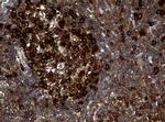 NME1 Antibody in Immunohistochemistry (Paraffin) (IHC (P))