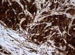 NME1 Antibody in Immunohistochemistry (Paraffin) (IHC (P))