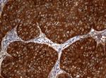 NME1 Antibody in Immunohistochemistry (Paraffin) (IHC (P))