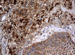 NME1 Antibody in Immunohistochemistry (Paraffin) (IHC (P))