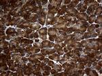 NME1 Antibody in Immunohistochemistry (Paraffin) (IHC (P))