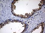 NME1 Antibody in Immunohistochemistry (Paraffin) (IHC (P))