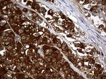 NME1 Antibody in Immunohistochemistry (Paraffin) (IHC (P))