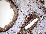 NME1 Antibody in Immunohistochemistry (Paraffin) (IHC (P))