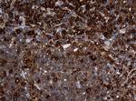 NME1 Antibody in Immunohistochemistry (Paraffin) (IHC (P))