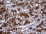 NME1 Antibody in Immunohistochemistry (Paraffin) (IHC (P))