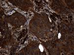 NME1 Antibody in Immunohistochemistry (Paraffin) (IHC (P))