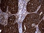 NME1 Antibody in Immunohistochemistry (Paraffin) (IHC (P))