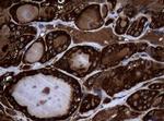 NME1 Antibody in Immunohistochemistry (Paraffin) (IHC (P))