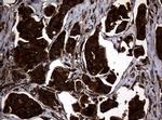 NME1 Antibody in Immunohistochemistry (Paraffin) (IHC (P))