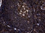 NME1 Antibody in Immunohistochemistry (Paraffin) (IHC (P))