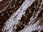 NME1 Antibody in Immunohistochemistry (Paraffin) (IHC (P))