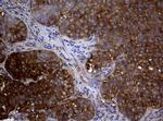 NME1 Antibody in Immunohistochemistry (Paraffin) (IHC (P))