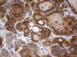 NME1 Antibody in Immunohistochemistry (Paraffin) (IHC (P))