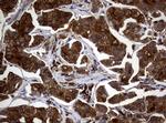 NME1 Antibody in Immunohistochemistry (Paraffin) (IHC (P))