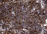 NME1 Antibody in Immunohistochemistry (Paraffin) (IHC (P))