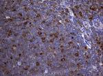 NME1 Antibody in Immunohistochemistry (Paraffin) (IHC (P))