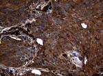NME1 Antibody in Immunohistochemistry (Paraffin) (IHC (P))